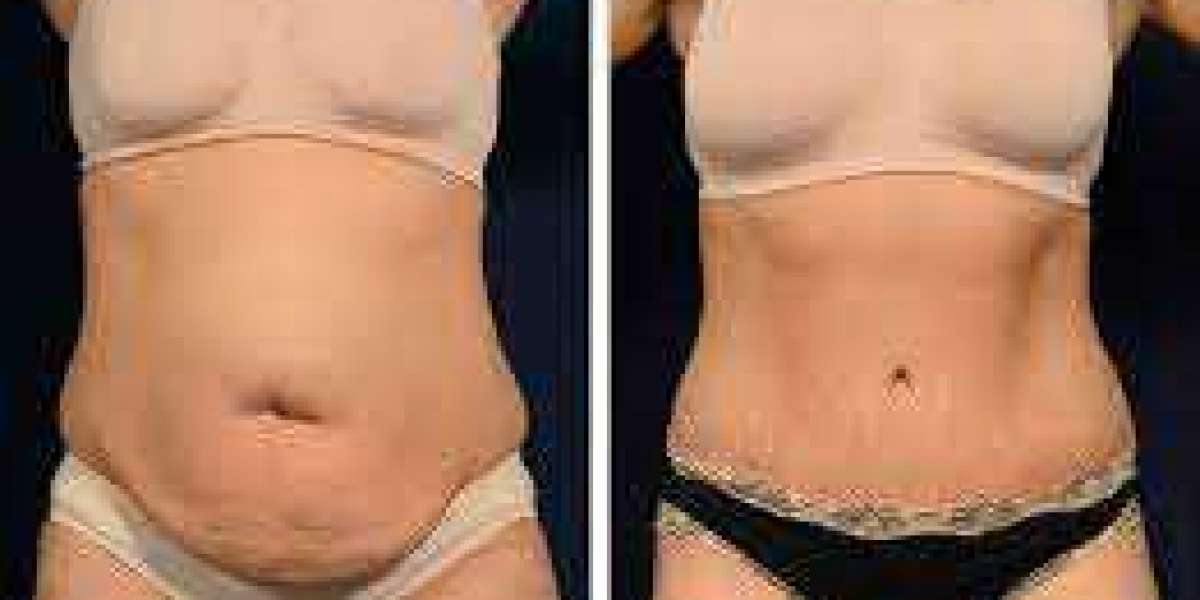 Okinawa Flat Belly Tonic Supplement Boosts Metabolism