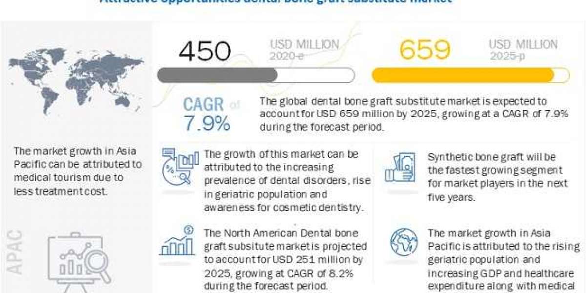 Dental Bone Graft Substitute Market Size, Industry Trends, Key Players and Outlook