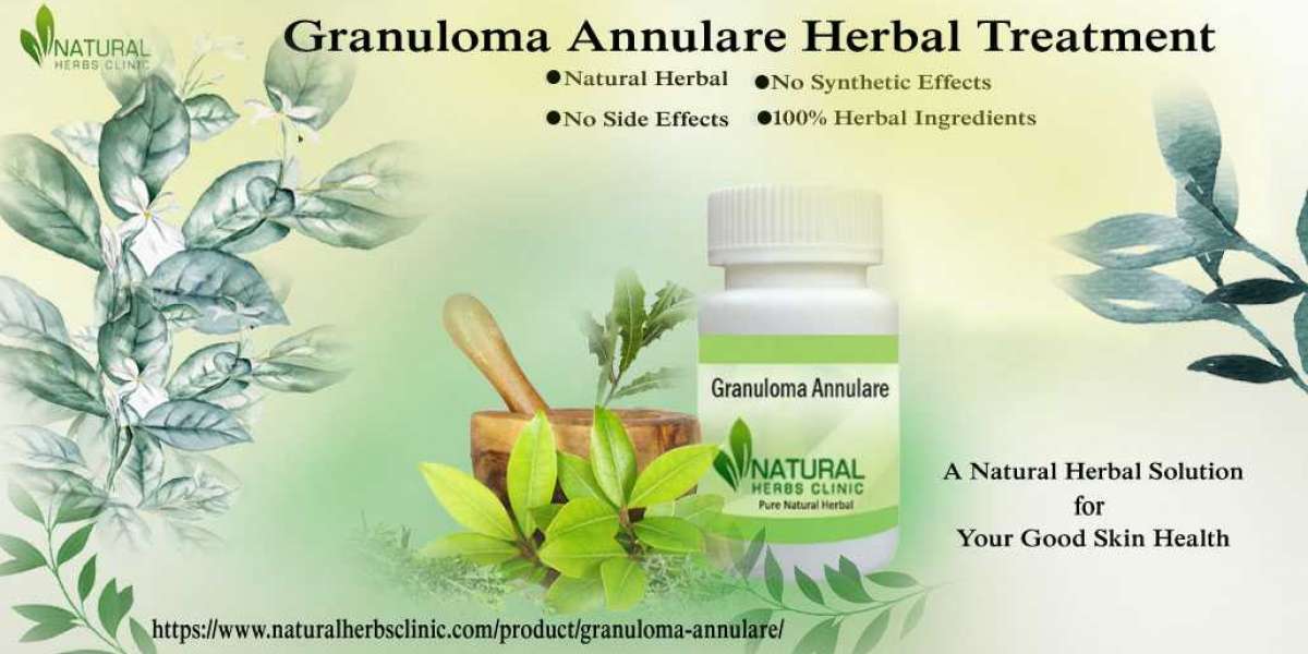 Simple and Powerful Home Remedies for Granuloma Annulare