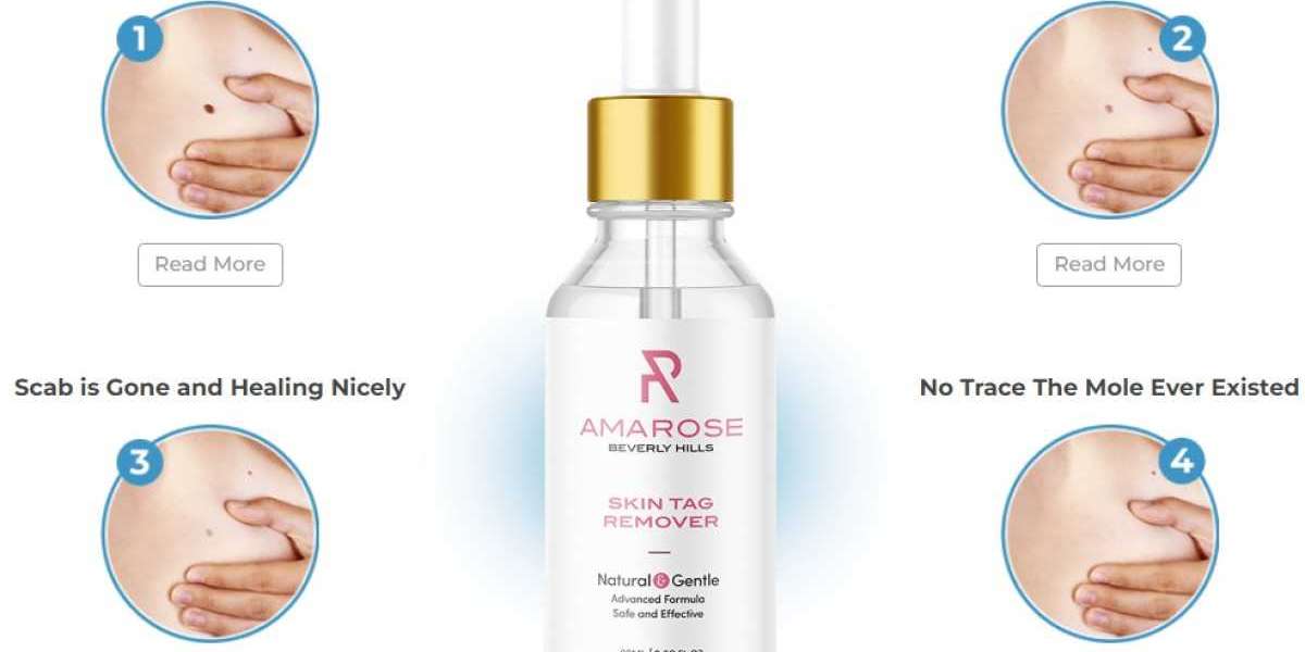 Amarose Skin Tag Remover Reviews – Safe Results or Fake Health Claims?