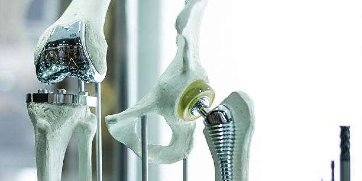 Knee Reconstruction Devices Market Growing at a CAGR of 4.9% During 2022 to 2029