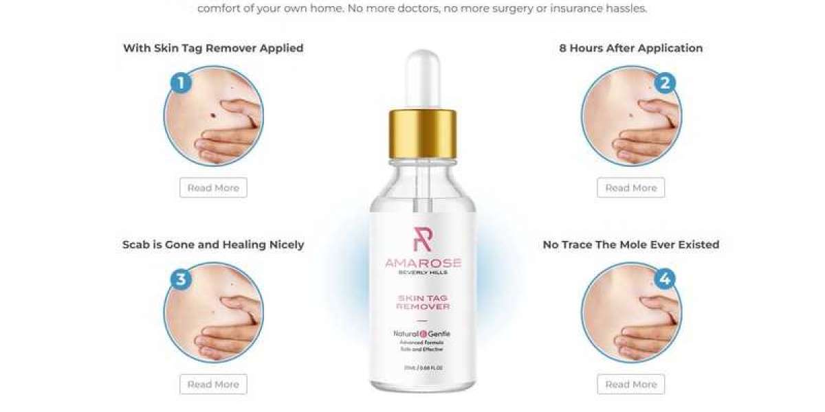 The 7 Secrets That You Shouldn't Know About Amarose Skin Tag Remover Reviews!