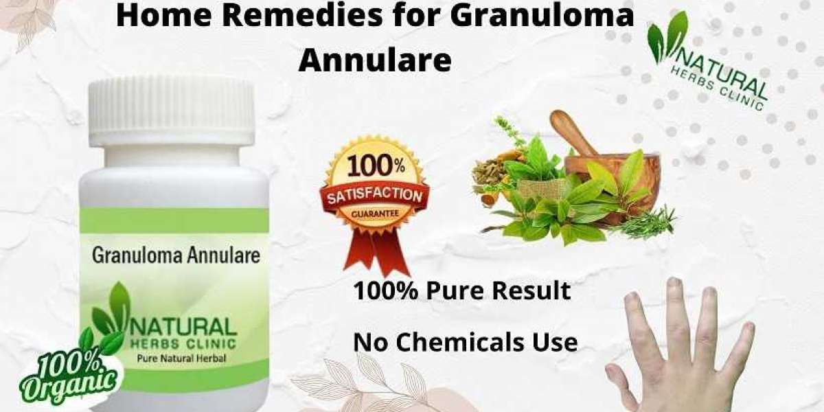 Granuloma Annulare Utilize Best Herbal Supplements to Recover It