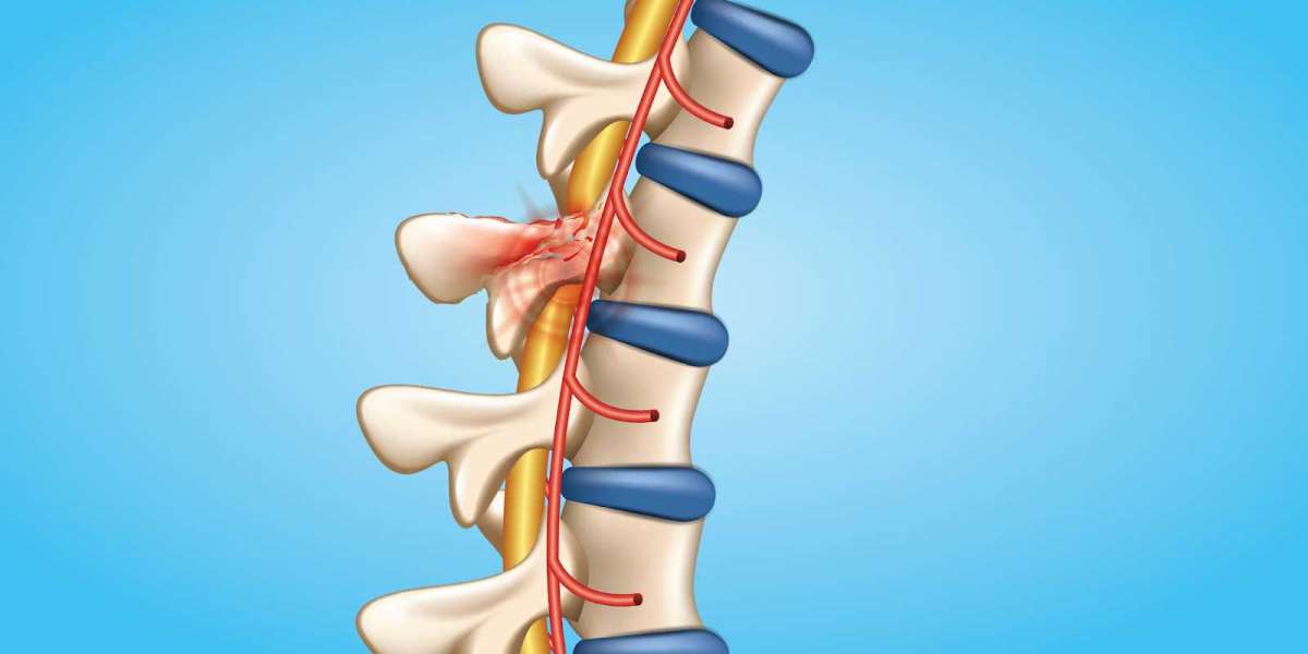 Spinal Cord Injury Symptoms and Treatments