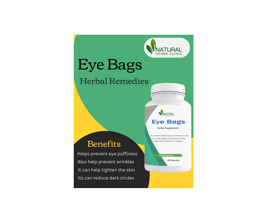 Home Remedies for Eye Bags: Effective Treatment by Natural Herbs Clinic