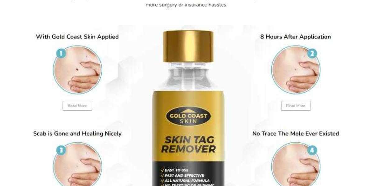 Gold Coast Skin Tag Remover Price!Gold Coast Skin Tag Remover!