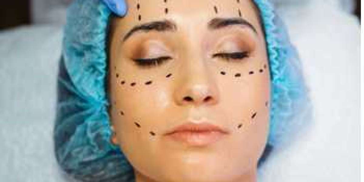 Benefits of Botox injections as a cosmetic treatment
