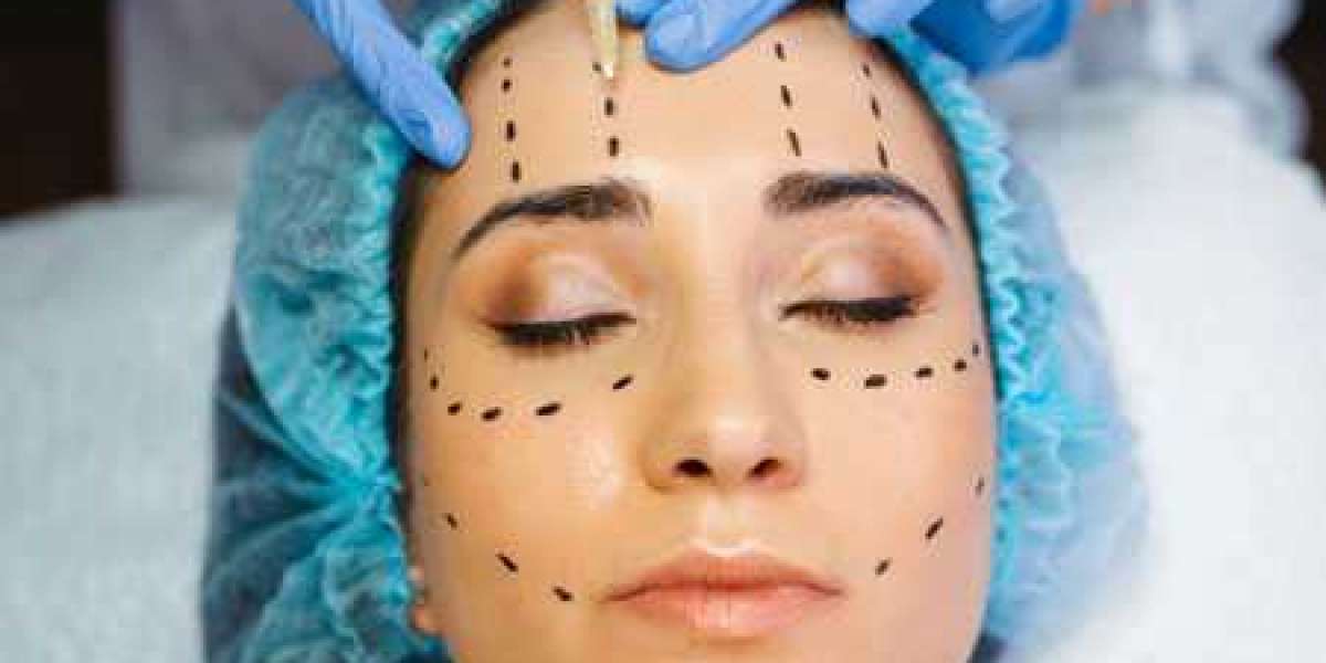 What are the benefits of Botox Injections in Loas Angeles?