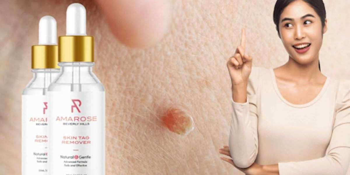 Paradise Skin Tag Remover 2023 – Trusted Brand or Fake Ingredients?