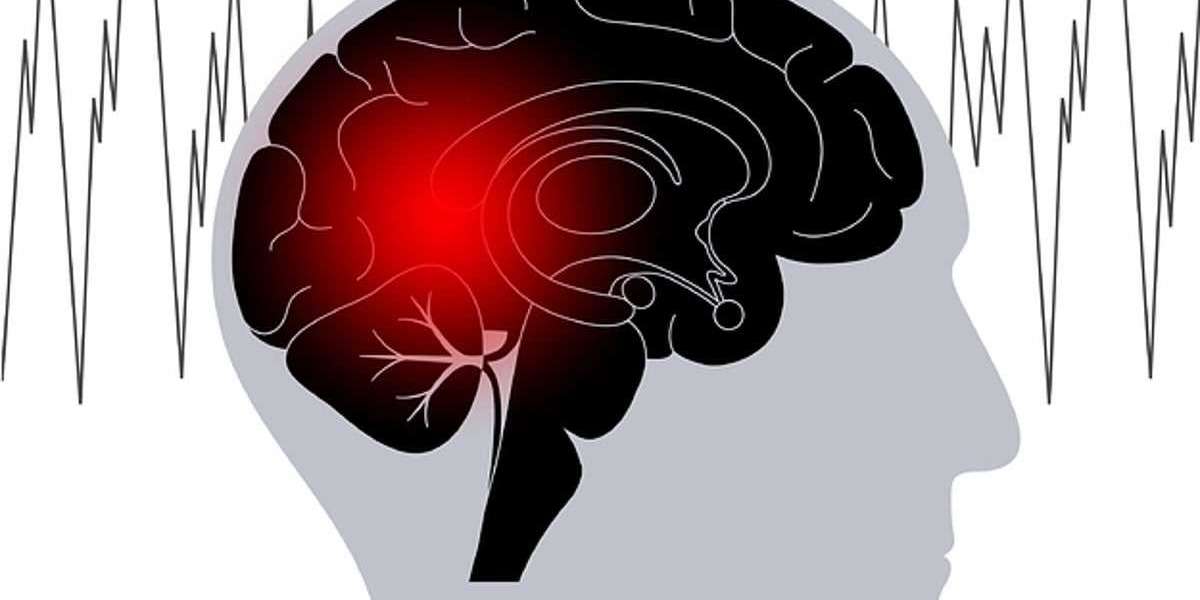 Epilepsy Market Share, Demonstrates a Spectacular Growth by 2030
