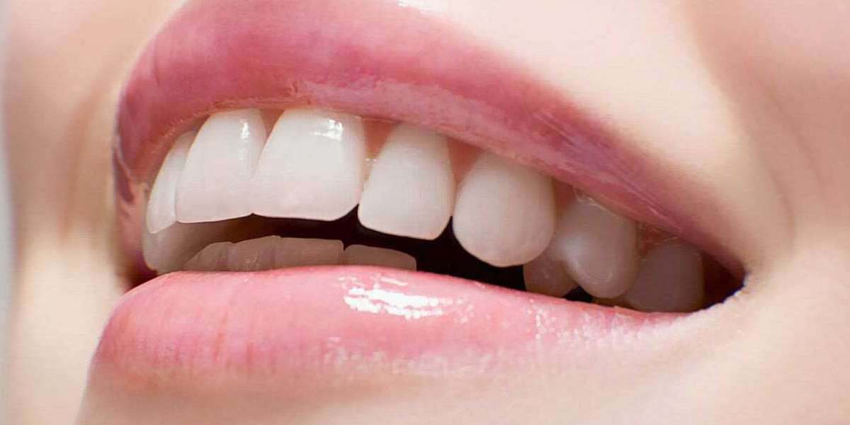 Prodentim:-Pills Really Legit Or Big white teeth  Scam?