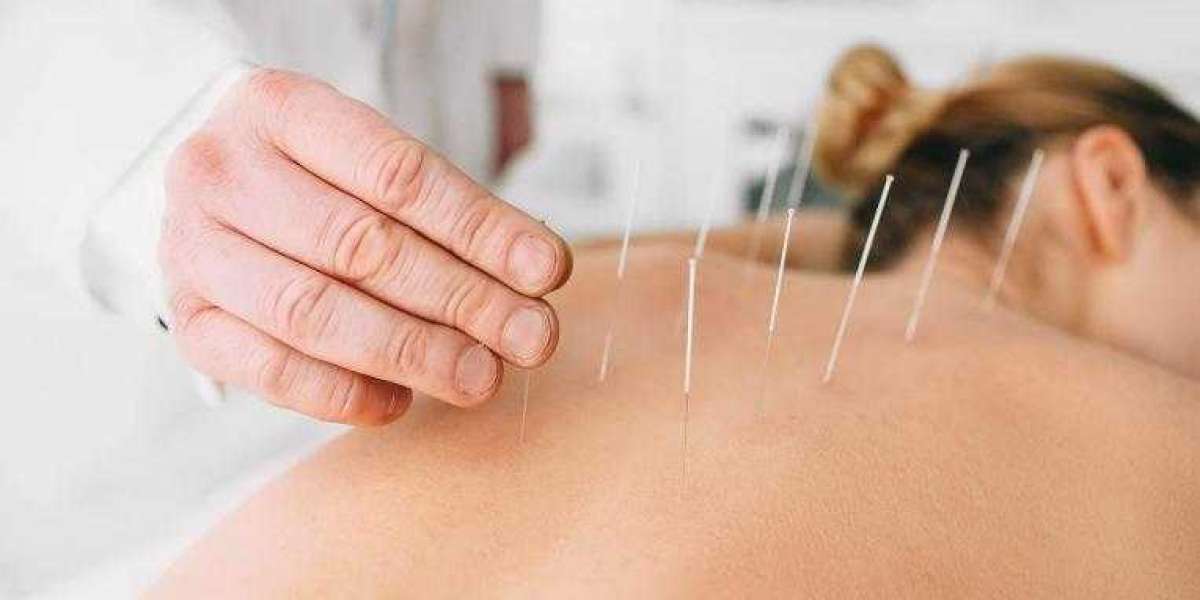 Acupuncture Market Share, Global Snapshot Analysis and Growth Opportunities, Emerging Trends by 2030