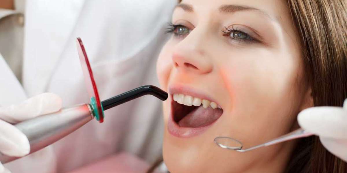 Dental Implants - What You Need to Know?