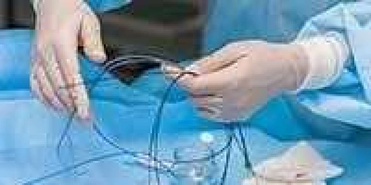 Catheters Market worth $24.2 billion by 2025 - Exclusive Report by MarketsandMarkets™