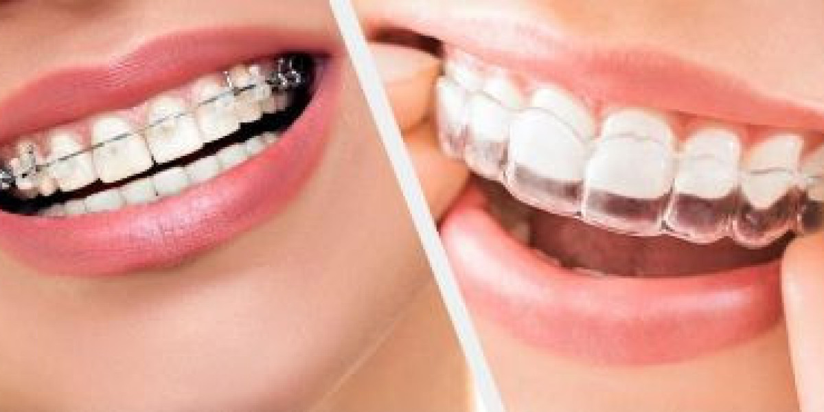 Orthodontics Market to See Huge Growth by 2030