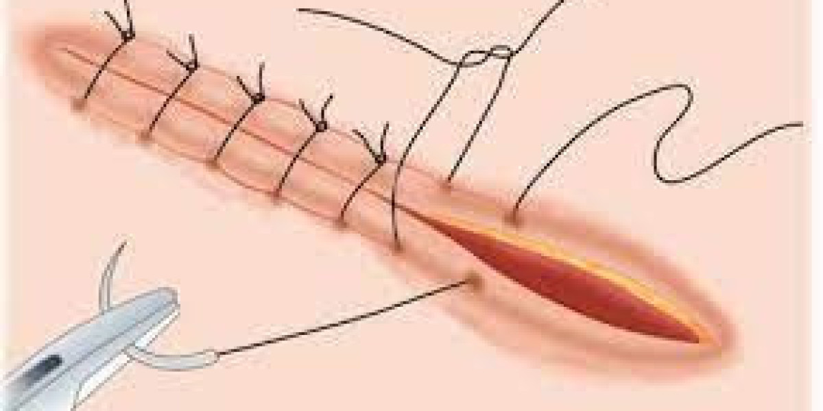 Sutures Market Huge Growth in Future Scope 2023-2030