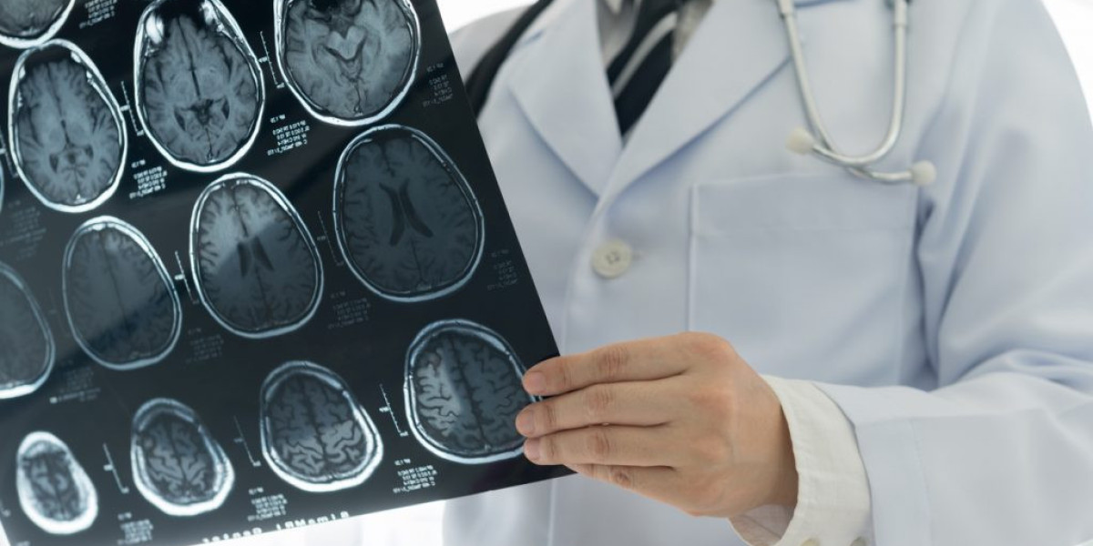 Discover the Best Neurologist in Pune at Poona Hospital