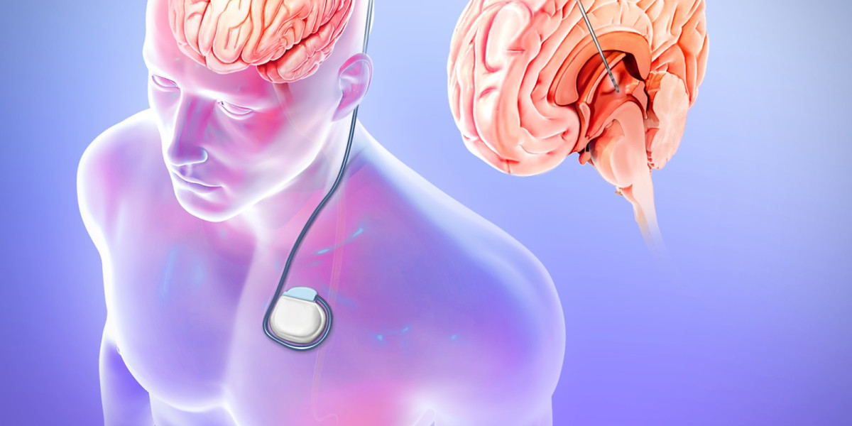 Global Epilepsy Surgery Market Share Emergence 2023-2030, Insights on Industry Size & Growth
