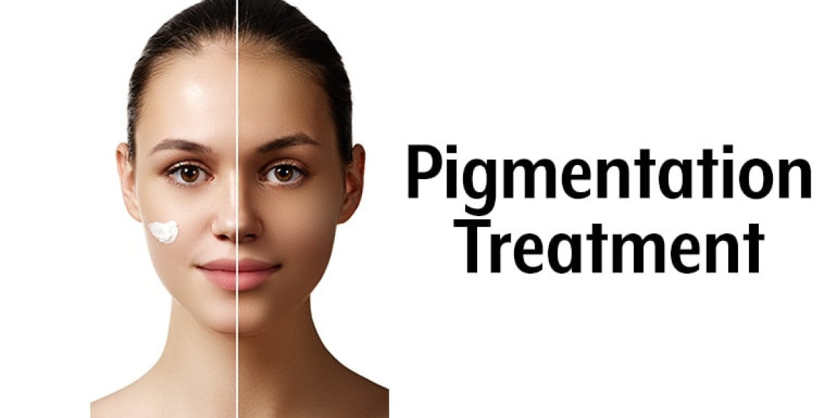 How to Combat Pigmentation Effective Treatment Strategies?