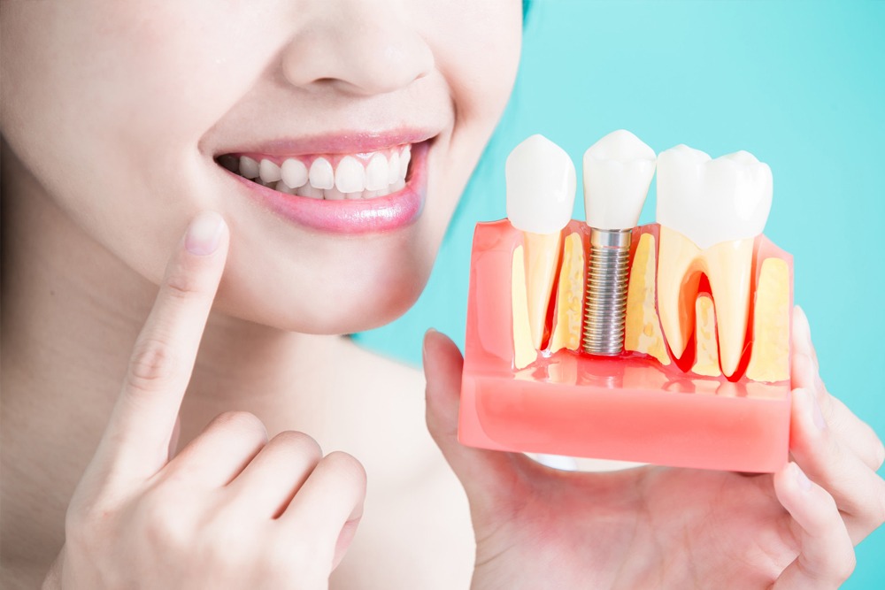 Best in class dental implant in Chandigarh- Esthetica