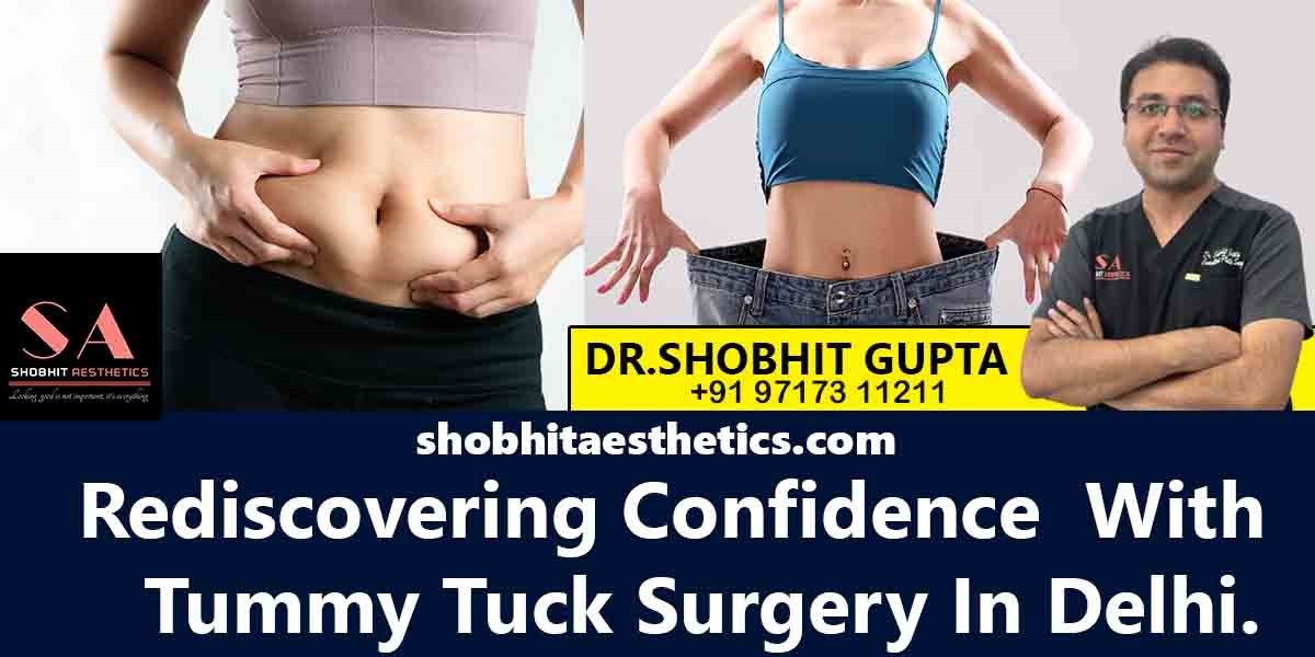 Tummy tuck surgery in Delhi: Expert tummy tuck solutions