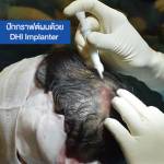 Hair Transplant Bangkok