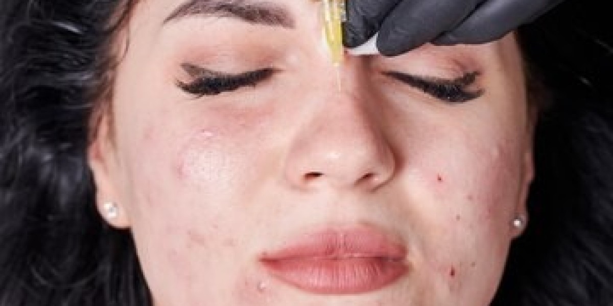"Renew Your Skin with Morpheus8 Treatment"