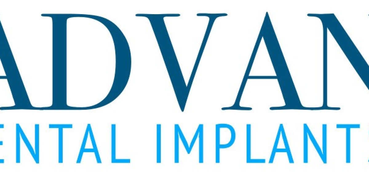How Successful are All On 4 Dental Implants?