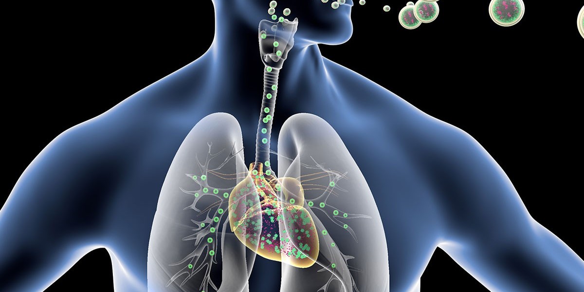 Respiratory Tract Infection Treatment: Understanding, Treating, and Preventing Common Respiratory Illnesses