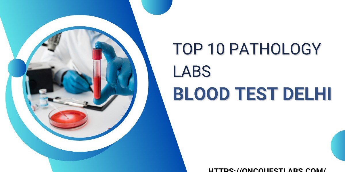 Top 10 Pathology Lab Blood Test Delhi