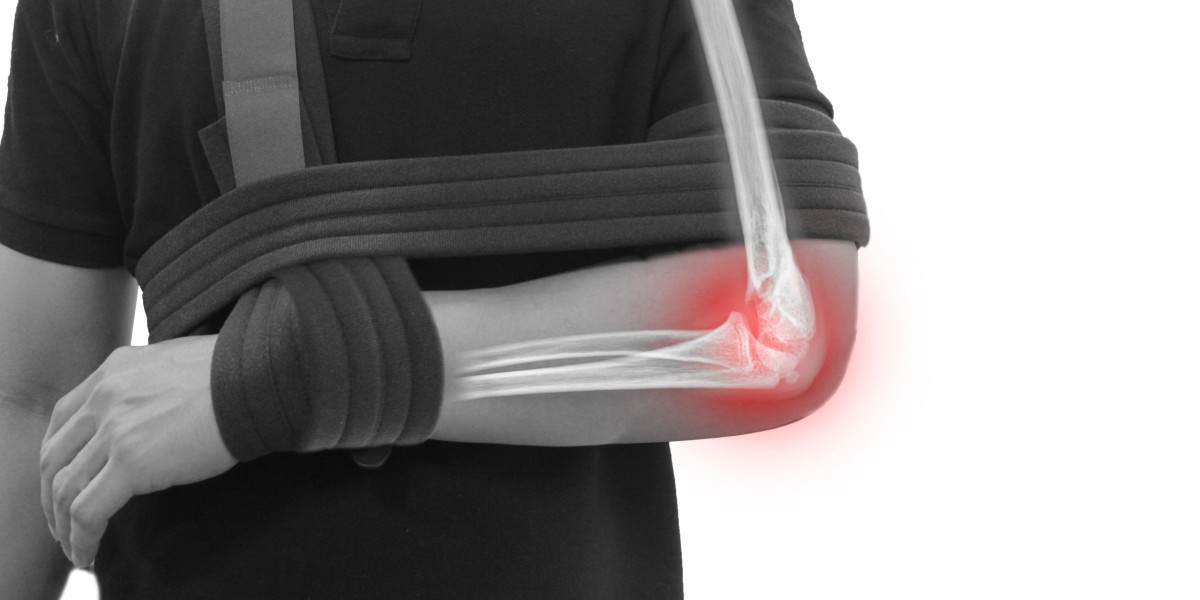 From Pain to Progress: Advancements in Global Elbow Replacement Procedures