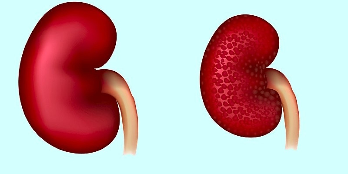 Diabetic Kidney Disease: Understanding the Link Between Diabetes and Kidney Damage