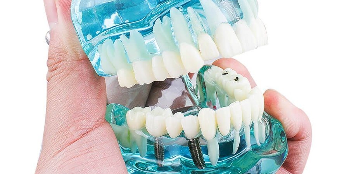 Orthodontic Brackets Market will surge driven by increasing adoption of orthodontic treatment