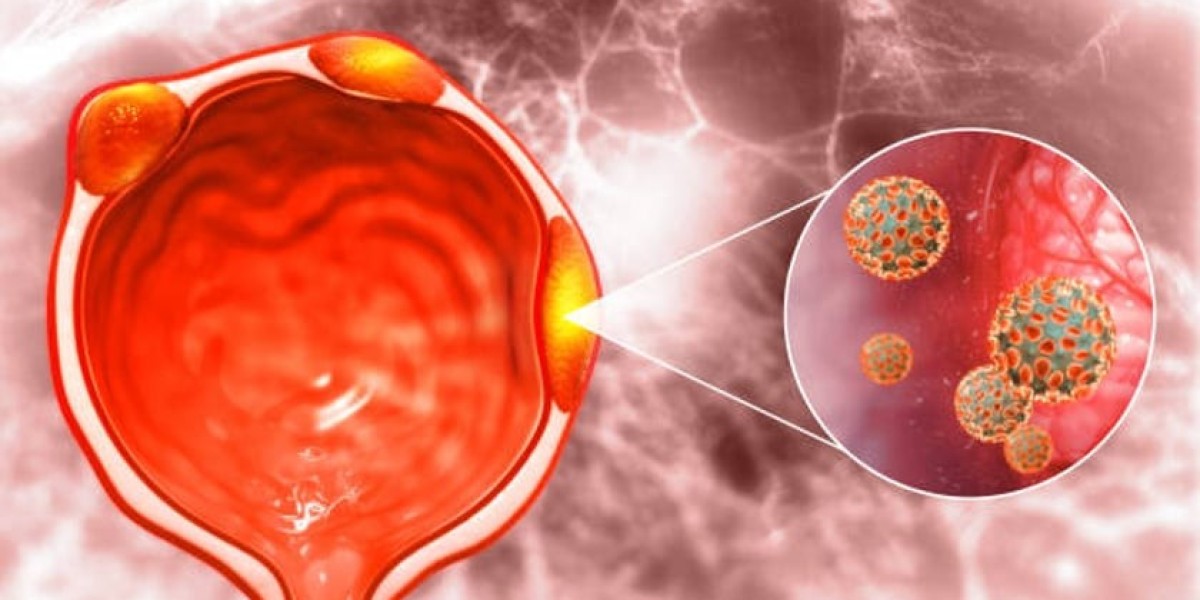 Navigating U.S. Urea Cycle Disorders Treatment: A Comprehensive Guide