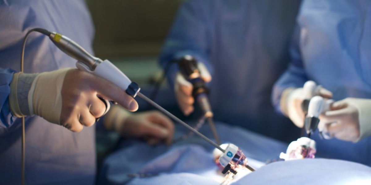 Exploring the Impact of Laparoscopic Electrodes on Minimally Invasive Surgery Across the Globe