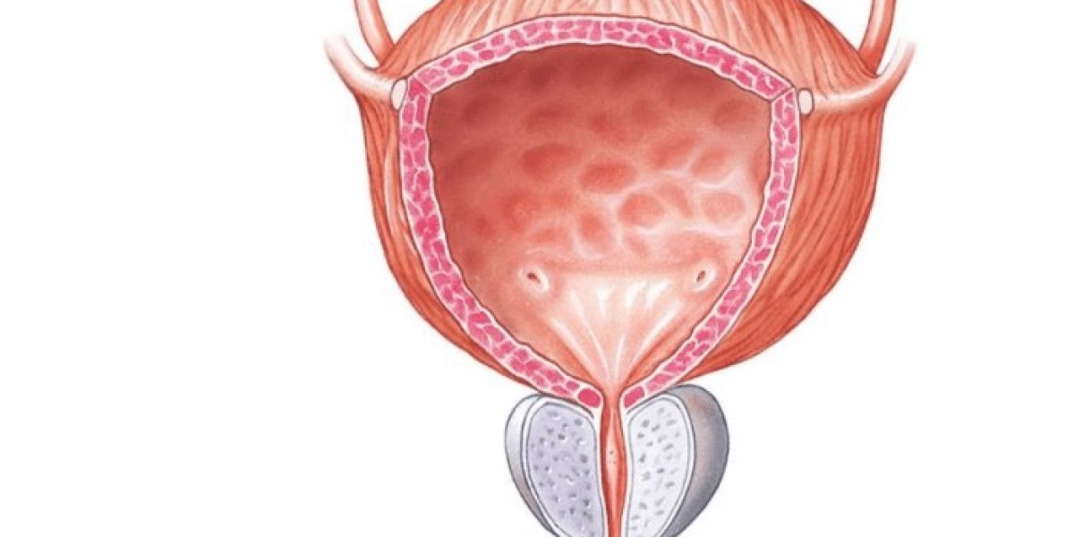 Exploring Growth Opportunities in the Bladder Liners Market: Trends and Insights