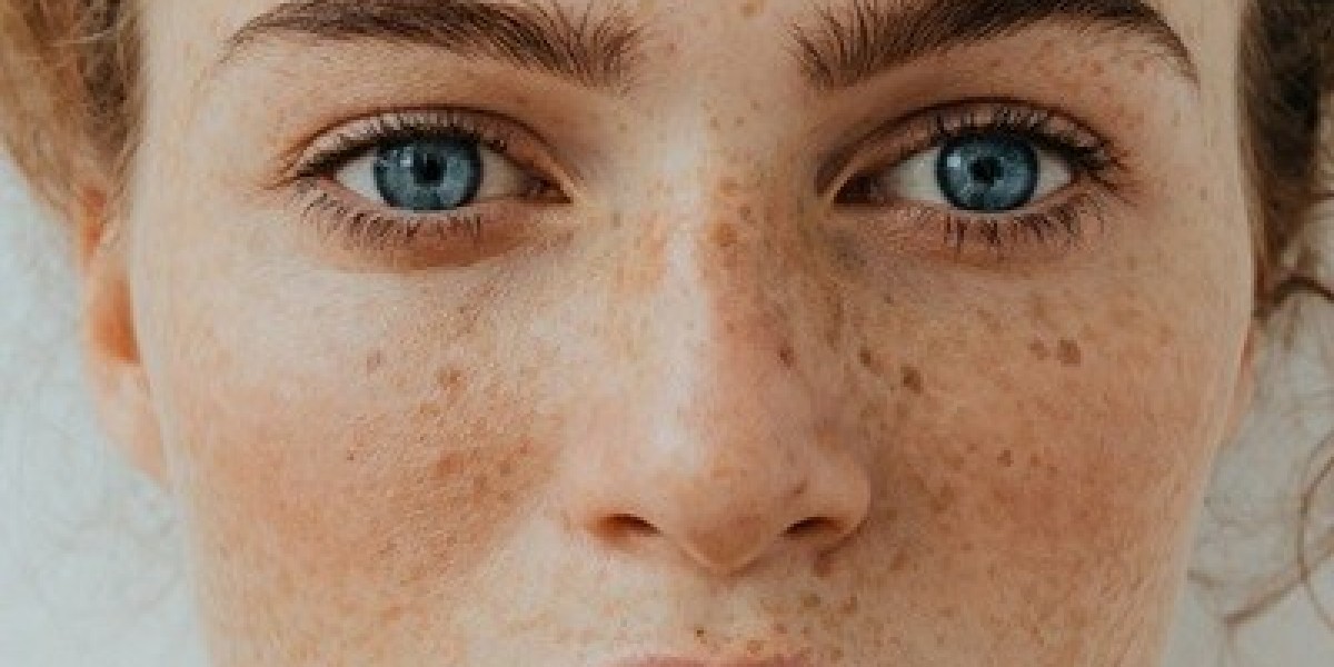 Exploring the Benefits of Pigmentation Treatment