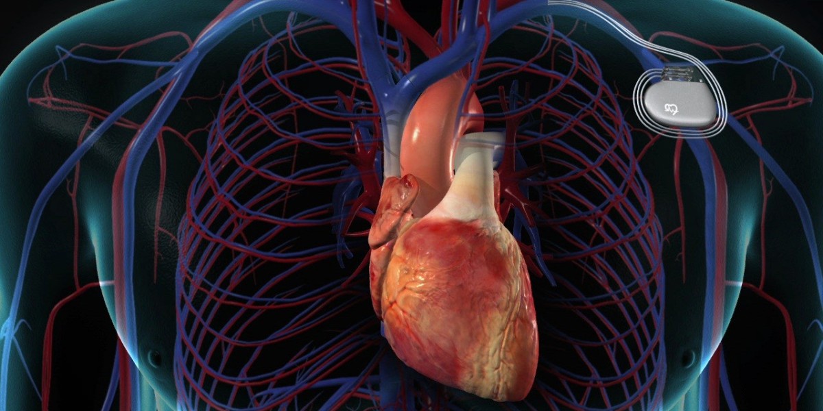 Emerging Trends in the Cardiac Pacemaker Industry