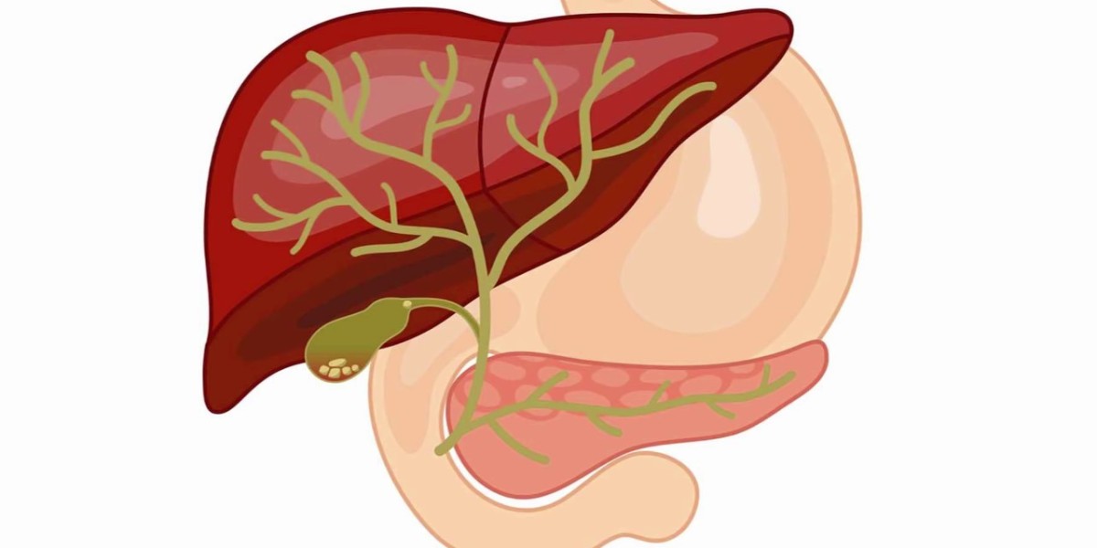 Navigating the Maze: Understanding Bile Duct Cancer