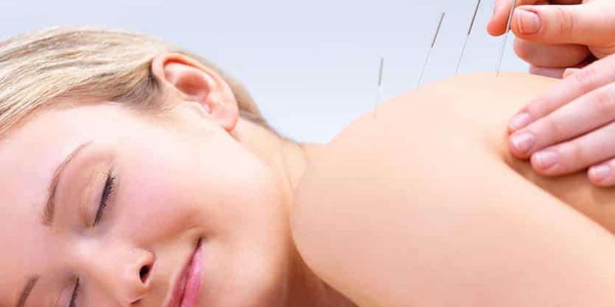 Exploring Common Types of Pain Treated with Acupuncture in Morristown