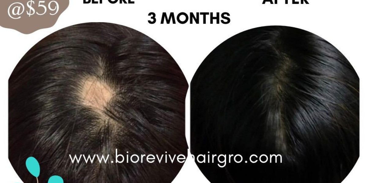 Experience Ultimate Hair Growth with BioReviveHairGro