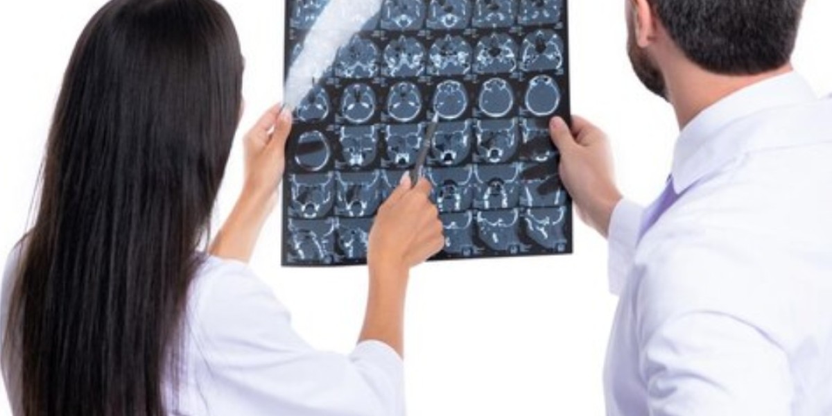 Types of Stroke: Causes, Symptoms, and Treatment