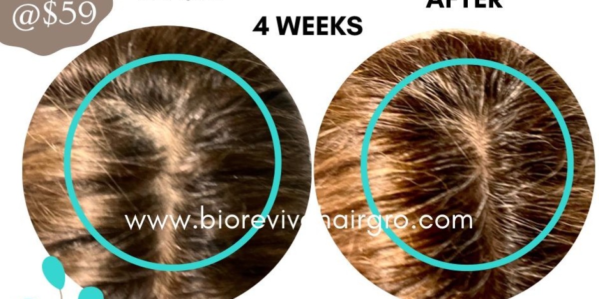 BioRevive HairGro's Top 10 Transformative Effects