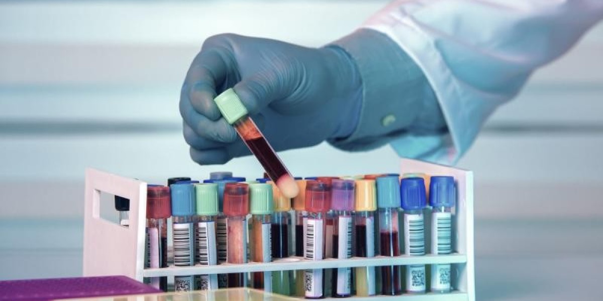 Global Biobanking Market Share, Growth, Report and Forecast 2024-2032