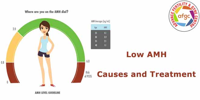 Low AMH – Causes, Diagnoses & Treatment Clinic in Delhi with High success Rate | AFGC