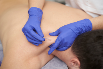 Dry Needling Melbourne - Effective Pain Relief