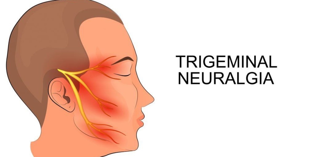 Effective Trigeminal Neuralgia Treatment Options