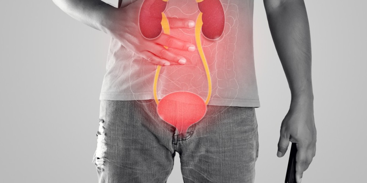 What are the symptoms of a kidney stone? What is the cure for it?