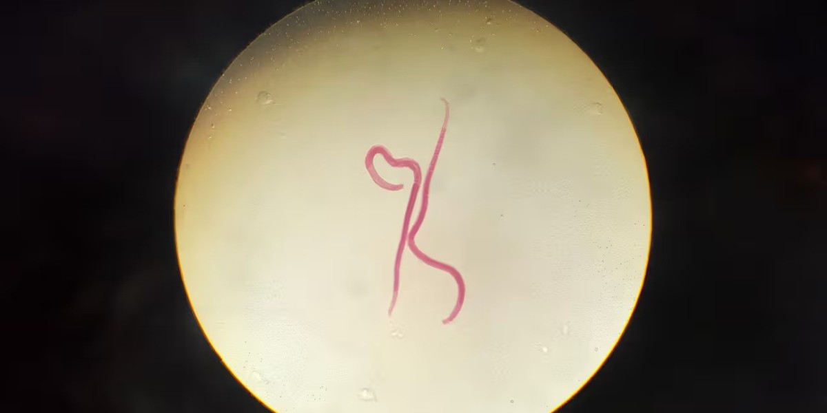 When Should You See a Doctor for a Parasitic Worm Infection?