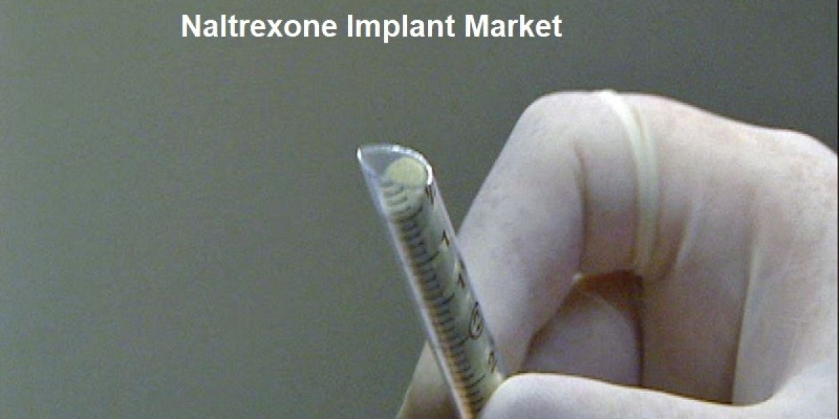 Naltrexone Implant Market to Surpass USD 857.49 Million by 2031 with 3.63% Growth Rate